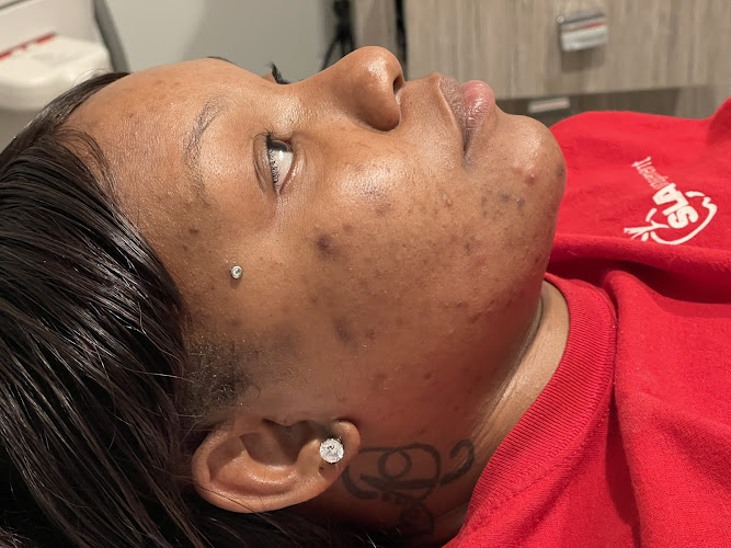 Blackledge Face Center