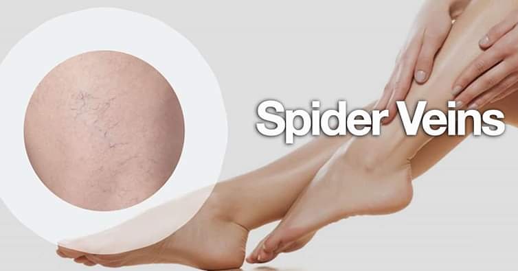 An Institute of Laser Hair Removal and Laser Therapy