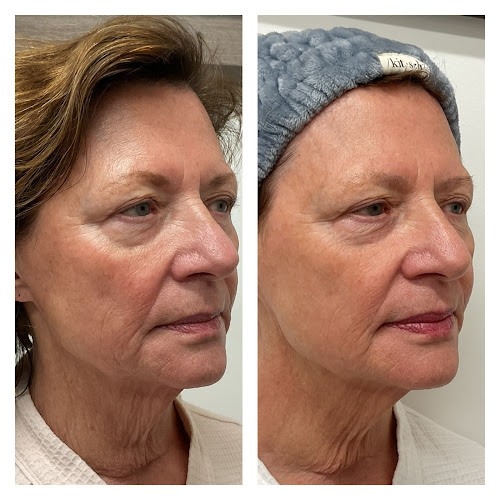 Talking Skin Aesthetics & Body Wellness