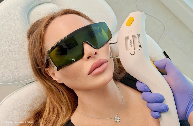 Novaskin Med Spa & Laser Center