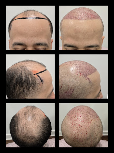 Phoenix Hair Restoration & Aesthetics