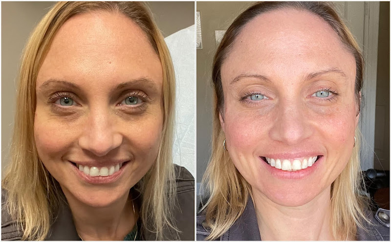 Complete Laser Clinic