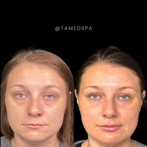 Transformations Aesthetics