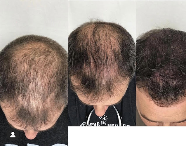 RNA Medical Aesthetics