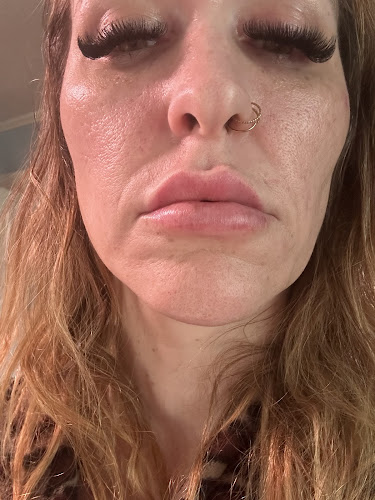 Ideal Image Winston Salem