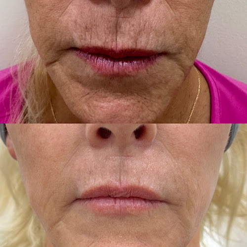 The North Shore Laser Center