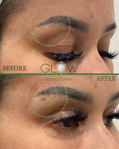 Glow Aesthetic Center Med Spa