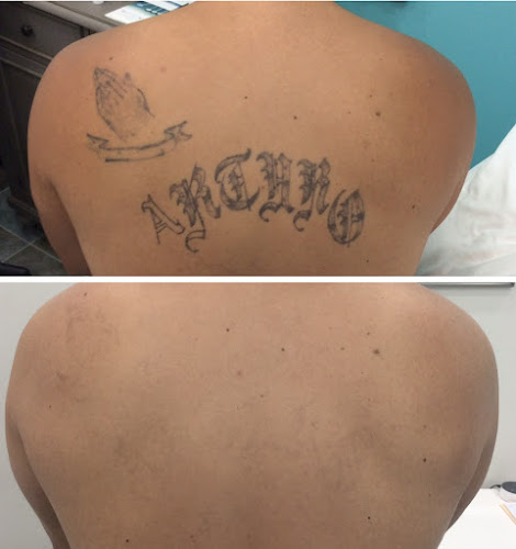 Bare Tattoo & Hair Removal