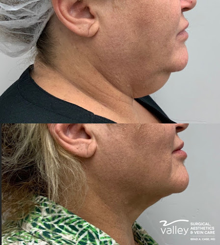 Valley Surgical, Aesthetics & Vein Care