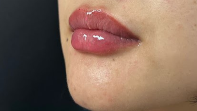 Zen Luxe Medspa & IV Lounge