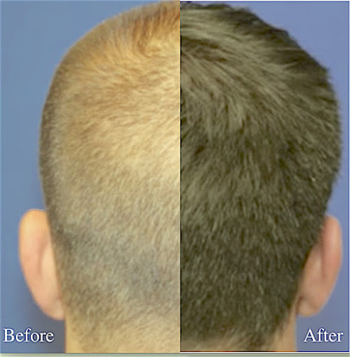 Texas Institute of Dermatology, Laser and Cosmetic Surgery